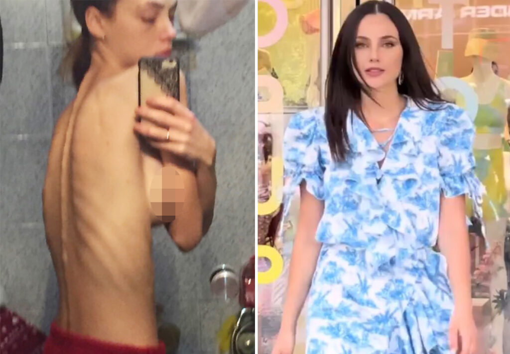 Rosalinda Cannavò pubblica le foto di quando era anoressica: ''Pesavo 32 chili e...''