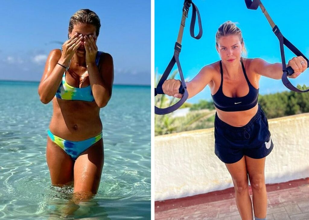 ''Dopo il secondo parto impossibile buttare giù la pancia, devo decidere se fare l'addominoplastica'': Costanza Caracciolo rivela la diastasi addominale ''Dopo il secondo parto impossibile buttare giù la pancia, devo decidere se fare l'addominoplastica'': Costanza Caracciolo rivela la diastasi addominale