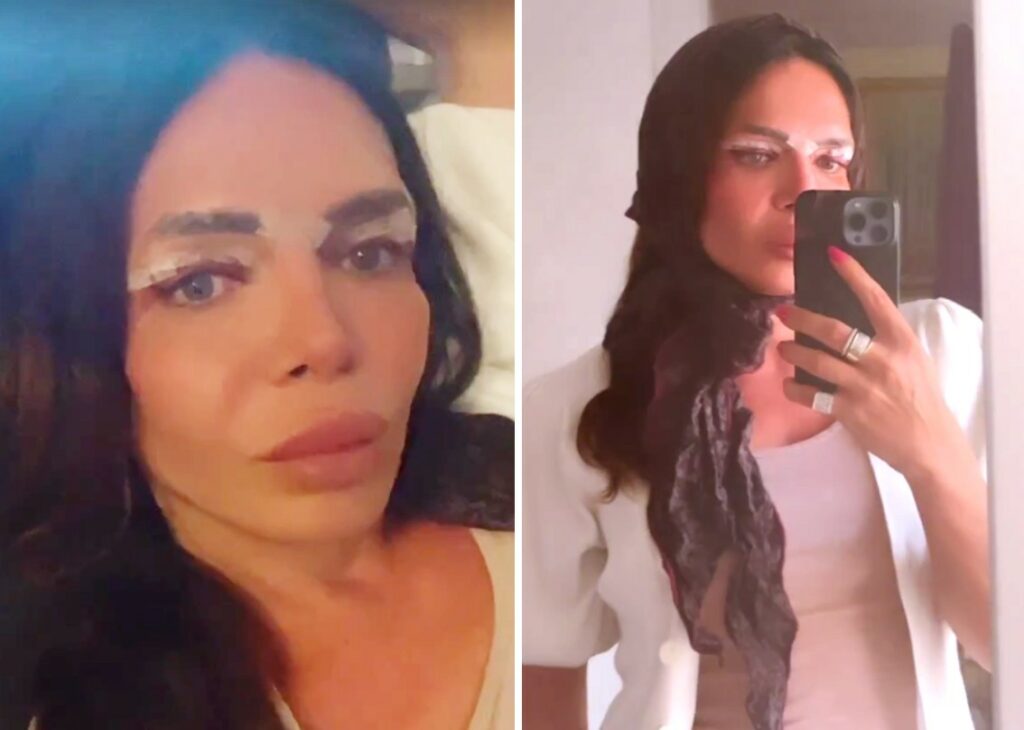 La truccatrice transgender di Anna Tatangelo mostra il nuovo intervento estetico e svela perché non ha ancora tagliato l'organo maschile La truccatrice transgender di Anna Tatangelo mostra il nuovo intervento estetico e svela perché non ha ancora tagliato l'organo maschile