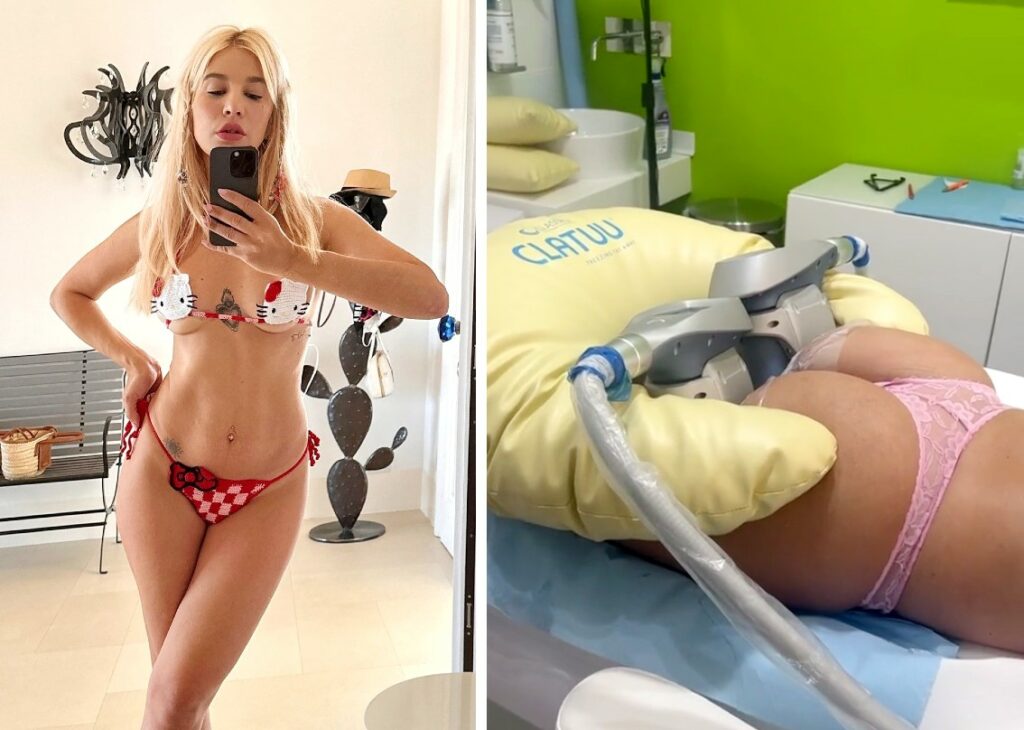 ''Dopo la gravidanza rimaste culotte de cheval'': Clizia Incorvaia fa la liposuzione non chirurgica