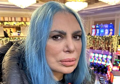 Loredana Bertè ricoverata a Roma per un  malore addominale: annullato il concerto