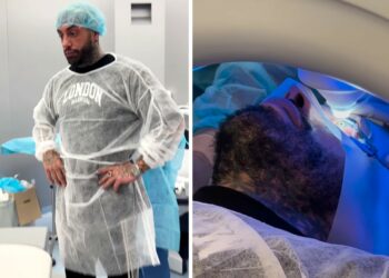 ''Dicono sia l'intervento di chirurgia plastica più pericoloso del mondo'': Francesco Chiofalo mostra le impressionanti immagini sotto ai ferri