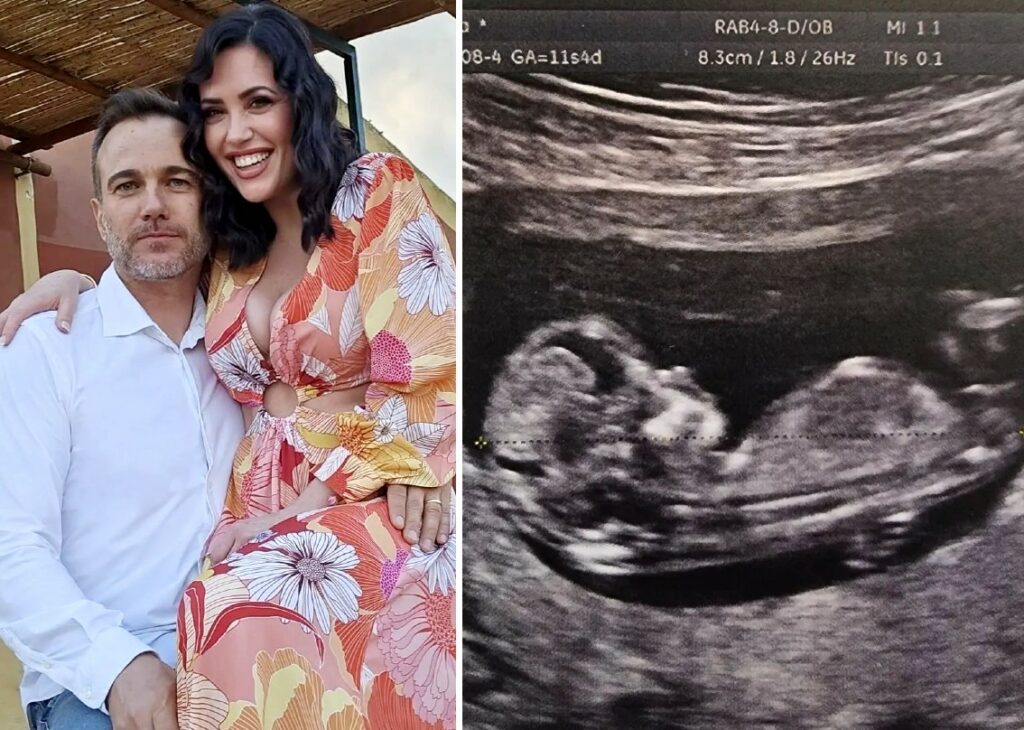 Claudia Ruggeri è incinta! 'Miss Claudia' di 'Avanti un altro' aspetta il primo figlio dal marito Marco, fratello di Sonia Bruganelli: l’annuncio