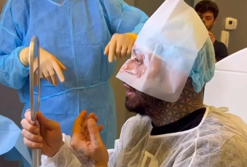 ''Ognuno è libero di fare ciò che vuole col suo corpo'': Francesco Chiofalo mostra immagini forti dell’intervento di cambio colore occhi e si difende