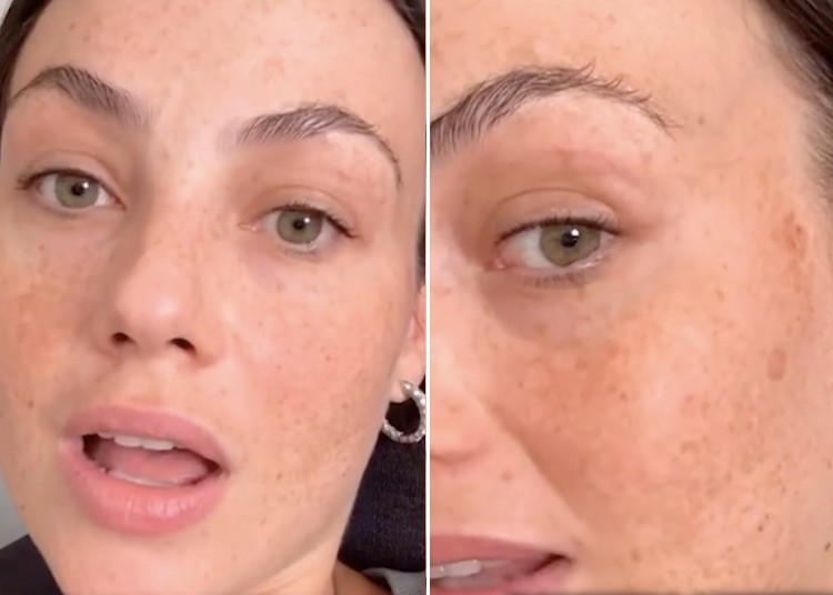 Rosalinda Cannavò mostra le macchie dovute alla gravidanza Rosalinda Cannavò mostra le macchie dovute alla gravidanza