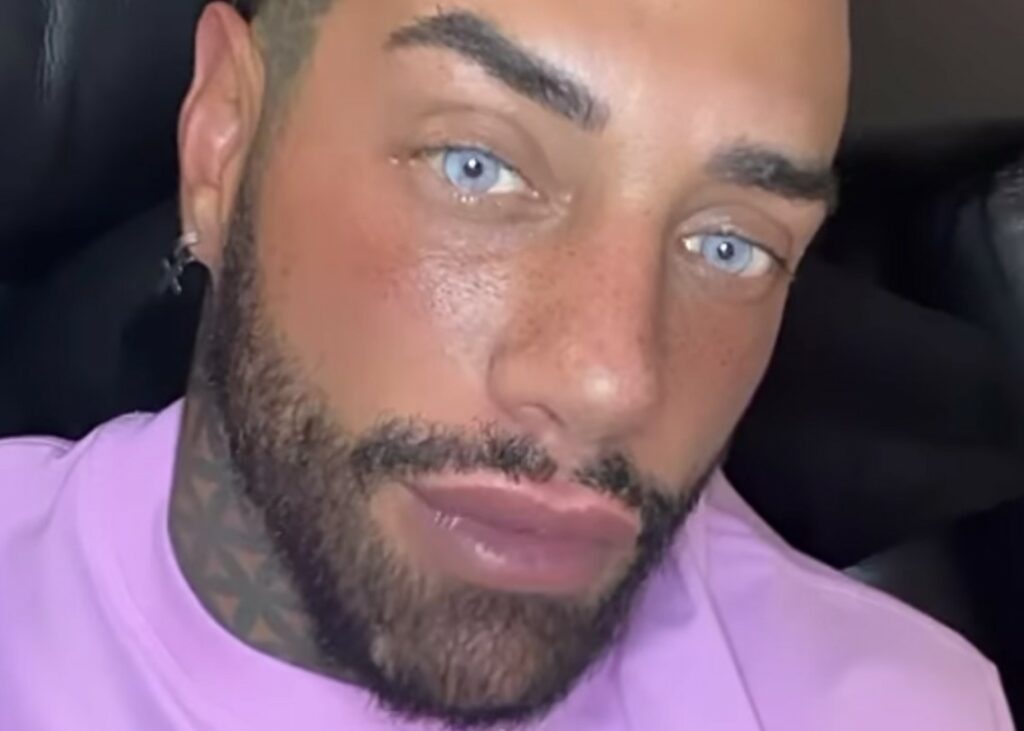 ''Non posso viaggiare fuori dall’Italia'': Francesco Chiofalo spiega il problema dopo l’ultimo intervento estetico ''Non posso viaggiare fuori dall’Italia'': Francesco Chiofalo spiega il problema dopo l’ultimo intervento estetico