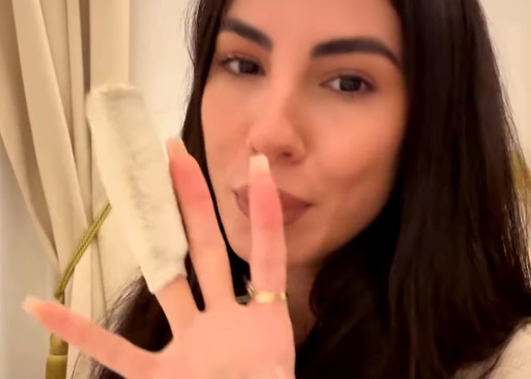 Giulia De Lellis mostra il dito dopo l'infortunio Giulia De Lellis mostra il dito dopo l'infortunio