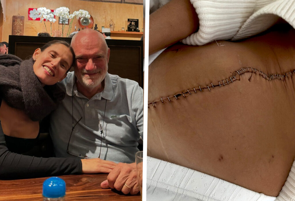 Bianca Balti mostra l'enorme cicatrice sulla pancia dopo l'intervento per rimuovere il tumore e si fa vedere sempre ottimista