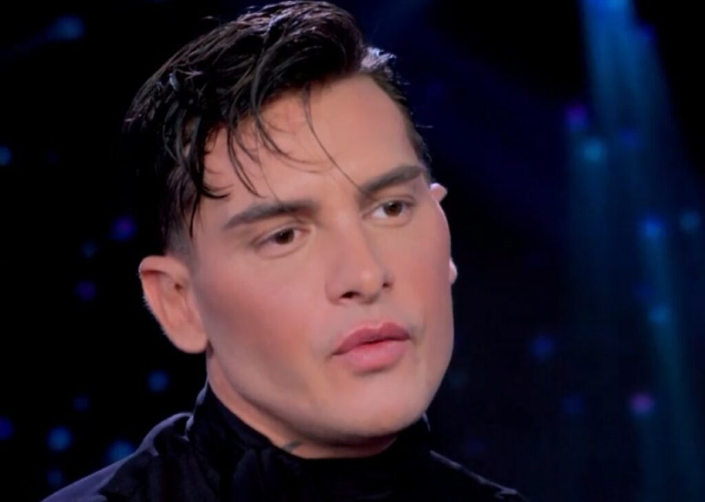 Alessandro Basciano torna in tv e appare diverso da prima, i commenti online: ''Irriconoscibile, si è rifatto''