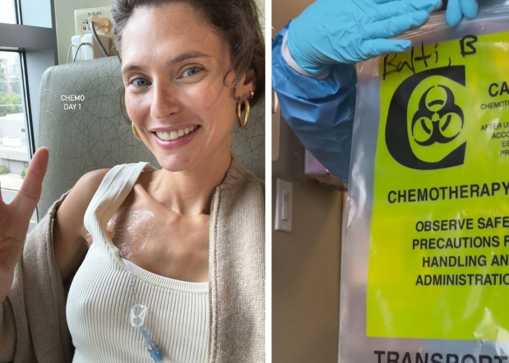 La lotta di Bianca Balti contro il tumore in foto: dall'operazione alla chemio