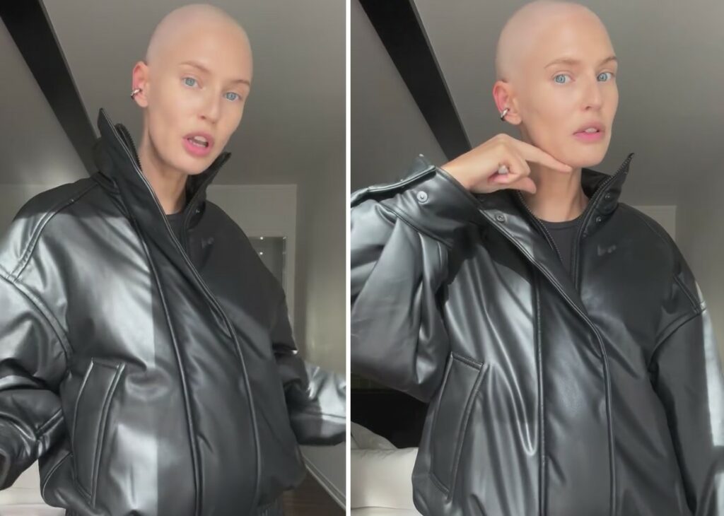 ''Non sembro il gatto nudo?'': Bianca Balti torna a mostrarsi senza capelli durante la chemioterapia ''Non sembro il gatto nudo?'': Bianca Balti torna a mostrarsi senza capelli durante la chemioterapia