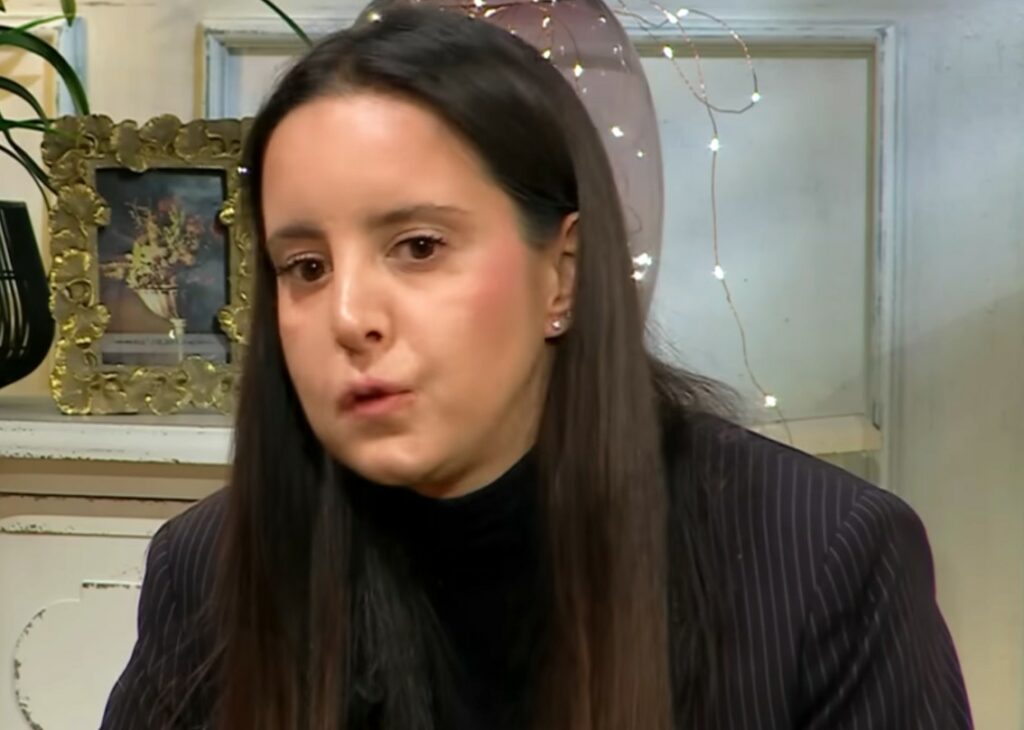 ''Sono nata con una paresi facciale'': la figlia dell'allenatore Roberto Mancini parla per la prima volta dell'asimmetria al viso ''Sono nata con una paresi facciale'': la figlia dell'allenatore Roberto Mancini parla per la prima volta dell'asimmetria al viso