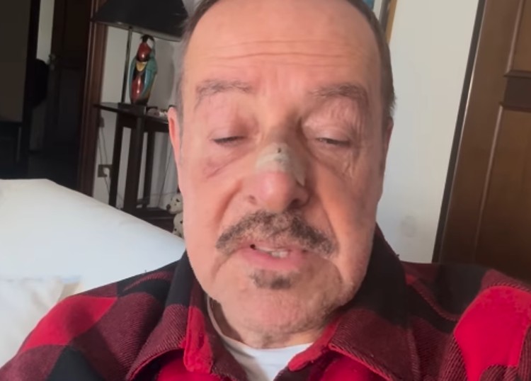 Massimo Lopez riappare sui social dopo essere stato investito in strada