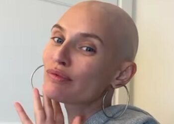 ''Con cicatrice sullo stomaco e senza capelli, non incarno lo stereotipo della modella'': la paura di Bianca Balti dopo diagnosi di tumore