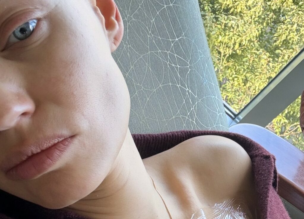 ''La prossima chemio sarà l'ultima'': Bianca Balti pubblica una foto in cui appare provata durante il trattamento antitumorale