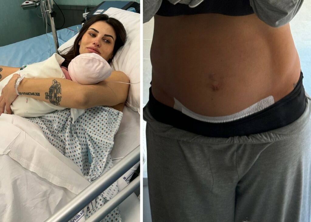 ''Ho fastidio ai punti interni'': l'ex Miss Italia Carolina Stramare mostra la pancia a pochissimi giorni dal parto e spiega come sta ''Ho fastidio ai punti interni'': l'ex Miss Italia Carolina Stramare mostra la pancia a pochissimi giorni dal parto e spiega come sta