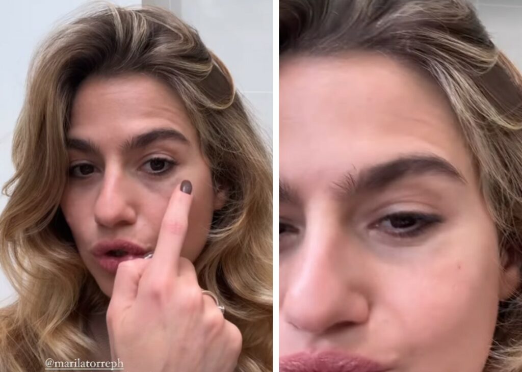 ''Mi ha spaccato la macchina fotografica in faccia'': Cristina Marino mostra l’occhio nero