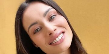 Marica Pellegrinelli conferma che le sue labbra sono naturali