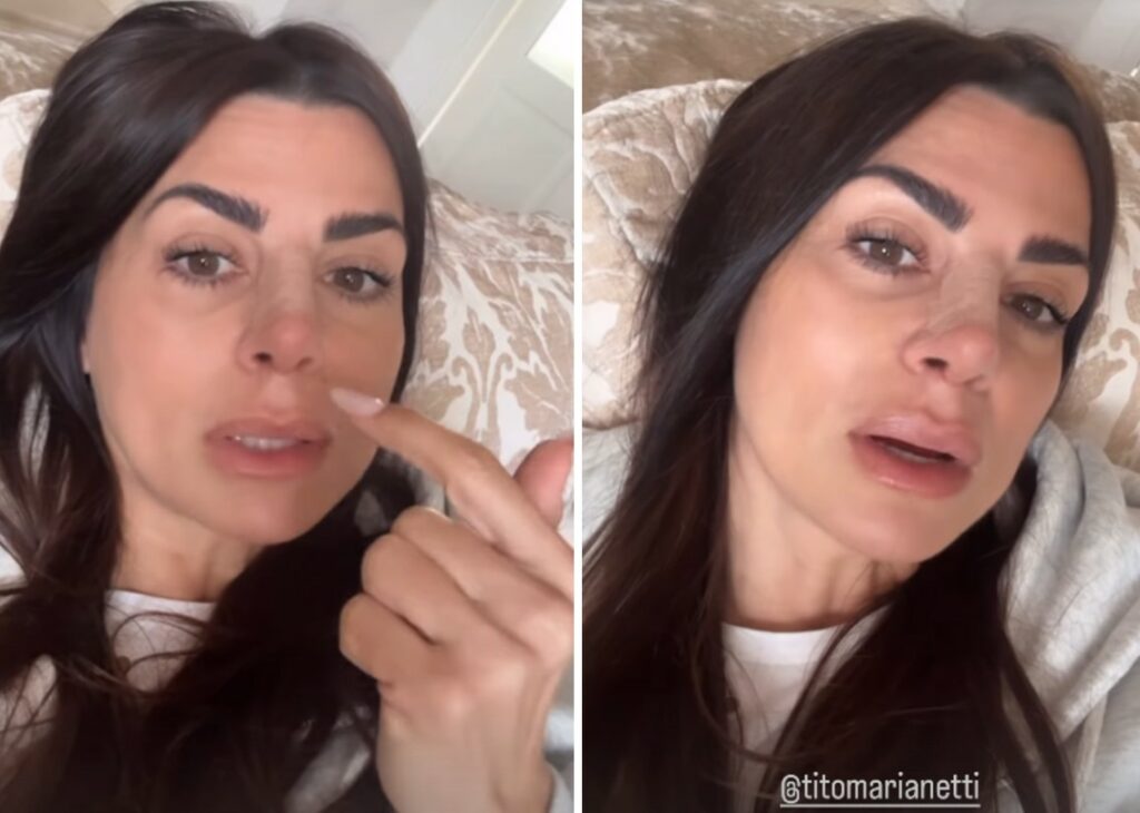 ''Il naso è stupendo'': l'ex tronista di 'Uomini e Donne' Serena Enardu ha fatto la rinoplastica, le immagini