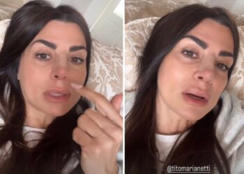 ''Il naso è stupendo'': l'ex tronista di 'Uomini e Donne' Serena Enardu ha fatto la rinoplastica, le immagini