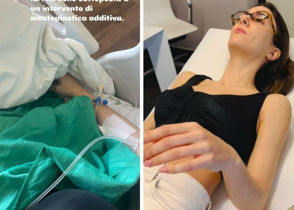 La sorella di Ilary Blasi si è rifatta il seno! Lo rivela sui social: Melory si mostra al controllo post operatorio della mastoplastica La sorella di Ilary Blasi si è rifatta il seno! Lo rivela sui social: Melory si mostra al controllo post operatorio della mastoplastica