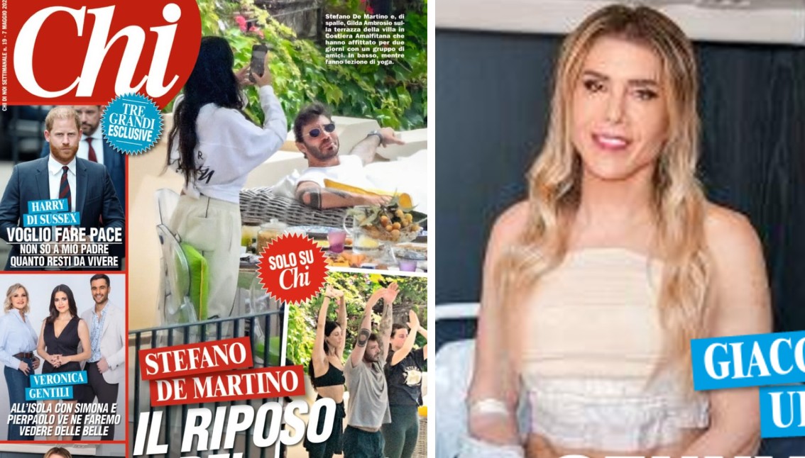 ''Ho voluto una terza'': il chirurgo estetico Giacomo Urtis rivela a sorpresa di aver fatto la mastoplastica - Gossip.it | News sul Gossip e VIP