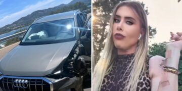 La chirurga dei vip Genny Urtis, ex Giacomo, mostra le ferite riportate dopo il bruttissimo incidente con l'auto in Sardegna: ''Fate attenzione''