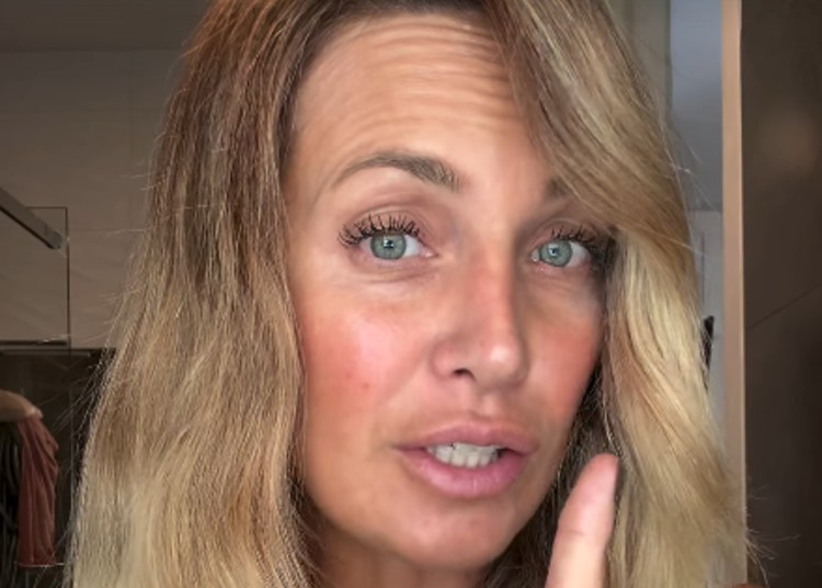 Katia Pedrotti sbotta per le critiche alla sua pelle