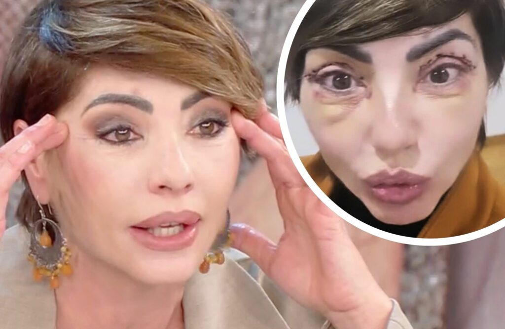 ''Guardate i miei occhi, sono bellissima'': Ilaria Galassi di 'Non è la Rai' si mostra soddisfatta in tv dopo l’intervento estetico ''Guardate i miei occhi, sono bellissima'': Ilaria Galassi di 'Non è la Rai' si mostra soddisfatta in tv dopo l’intervento estetico