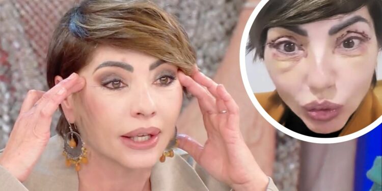 ''Guardate i miei occhi, sono bellissima'': Ilaria Galassi di 'Non è la Rai' si mostra soddisfatta in tv dopo l’intervento estetico