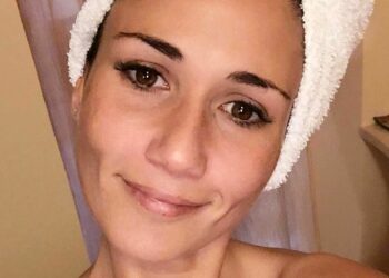 ''Annientata dal dolore'': l’attrice de ‘I Cesaroni’ Barbara Tabita racconta la battaglia contro la malattia e la cura che ha funzionato per lei