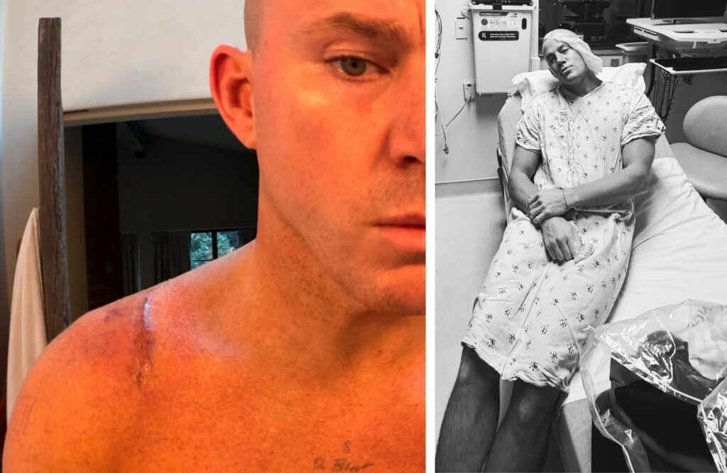 ''Colpa mia per non aver chiesto'': l’attore Channing Tatum sorpreso dalla grandezza della cicatrice del suo recente intervento, foto ''Colpa mia per non aver chiesto'': l’attore Channing Tatum sorpreso dalla grandezza della cicatrice del suo recente intervento, foto