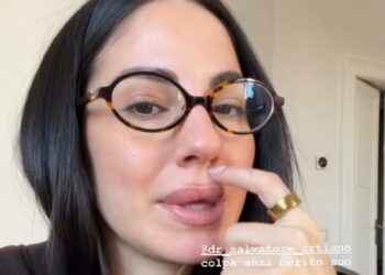 Giulia De Lellis dopo un anno torna a fare il botox, ma ha deciso di non ritoccare più le labbra Giulia De Lellis dopo un anno torna a fare il botox, ma ha deciso di non ritoccare più le labbra