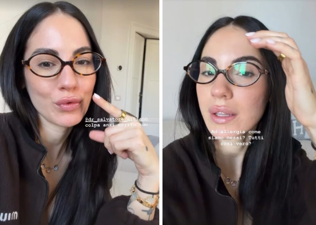 ''Non vedo l’ora che si attivi'': Giulia De Lellis svela di aver rifatto il Botox dopo circa un anno, guarda