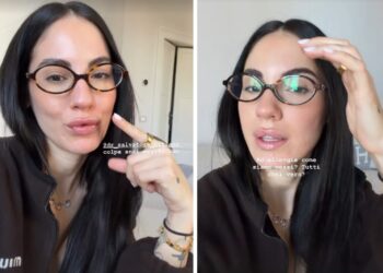 ''Non vedo l’ora che si attivi'': Giulia De Lellis svela di aver rifatto il Botox dopo circa un anno, guarda