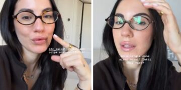 ''Non vedo l’ora che si attivi'': Giulia De Lellis svela di aver rifatto il Botox dopo circa un anno, guarda