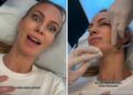 ''Io ho iniziato a 20 anni'': Taylor Mega si mostra mentre si fa il Botox e ammette di sottoporsi alle punturine da 12 anni