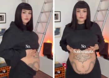 Giorgia Soleri mostra la sua ''pancia da endometriosi'' sul social per rispondere a chi le chiede se è incinta