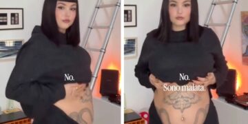 Giorgia Soleri mostra la sua ''pancia da endometriosi'' sul social per rispondere a chi le chiede se è incinta