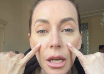 Karina Cascella parla dei ritocchi estetici